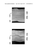 PROSTHETIC DEVICE HAVING DIAGONAL YARNS AND METHOD OF MANUFACTURING THE     SAME diagram and image