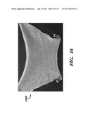 PROSTHETIC DEVICE HAVING DIAGONAL YARNS AND METHOD OF MANUFACTURING THE     SAME diagram and image