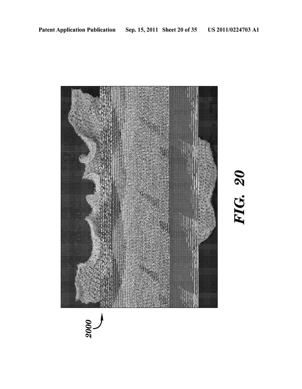 PROSTHETIC DEVICE HAVING DIAGONAL YARNS AND METHOD OF MANUFACTURING THE     SAME - diagram, schematic, and image 21