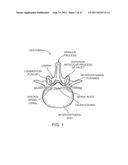 METHODS, SYSTEMS AND DEVICES FOR CARPAL TUNNEL RELEASE diagram and image