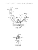 METHODS, SYSTEMS AND DEVICES FOR CARPAL TUNNEL RELEASE diagram and image