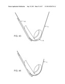 METHODS, SYSTEMS AND DEVICES FOR CARPAL TUNNEL RELEASE diagram and image