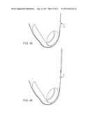 METHODS, SYSTEMS AND DEVICES FOR CARPAL TUNNEL RELEASE diagram and image