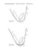 METHODS, SYSTEMS AND DEVICES FOR CARPAL TUNNEL RELEASE diagram and image