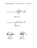 METHODS, SYSTEMS AND DEVICES FOR CARPAL TUNNEL RELEASE diagram and image