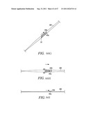 METHODS, SYSTEMS AND DEVICES FOR CARPAL TUNNEL RELEASE diagram and image