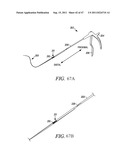 METHODS, SYSTEMS AND DEVICES FOR CARPAL TUNNEL RELEASE diagram and image