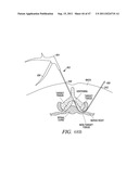 METHODS, SYSTEMS AND DEVICES FOR CARPAL TUNNEL RELEASE diagram and image