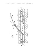 PERCUTANEOUS CATHETER AND GUIDEWIRE HAVING FILTER AND MEDICAL DEVICE     DEPLOYMENT CAPABILITIES diagram and image