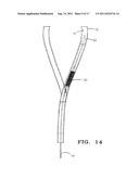 PERCUTANEOUS CATHETER AND GUIDEWIRE HAVING FILTER AND MEDICAL DEVICE     DEPLOYMENT CAPABILITIES diagram and image