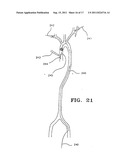 PERCUTANEOUS CATHETER AND GUIDEWIRE HAVING FILTER AND MEDICAL DEVICE     DEPLOYMENT CAPABILITIES diagram and image