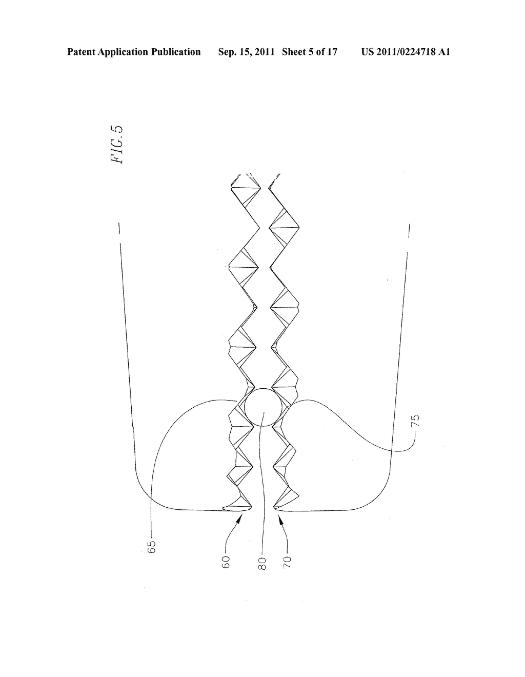 SURGICAL NEEDLE DRIVER AND METHOD OF MAKING THE SAME - diagram, schematic, and image 06