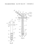 Universal Introducer diagram and image