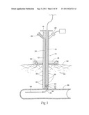 Universal Introducer diagram and image