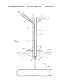 Universal Introducer diagram and image