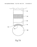 Universal Introducer diagram and image