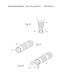 Universal Introducer diagram and image