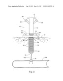 Universal Introducer diagram and image