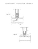 Universal Introducer diagram and image