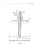 Universal Introducer diagram and image