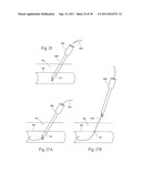 Universal Introducer diagram and image