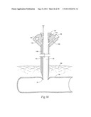 Universal Introducer diagram and image