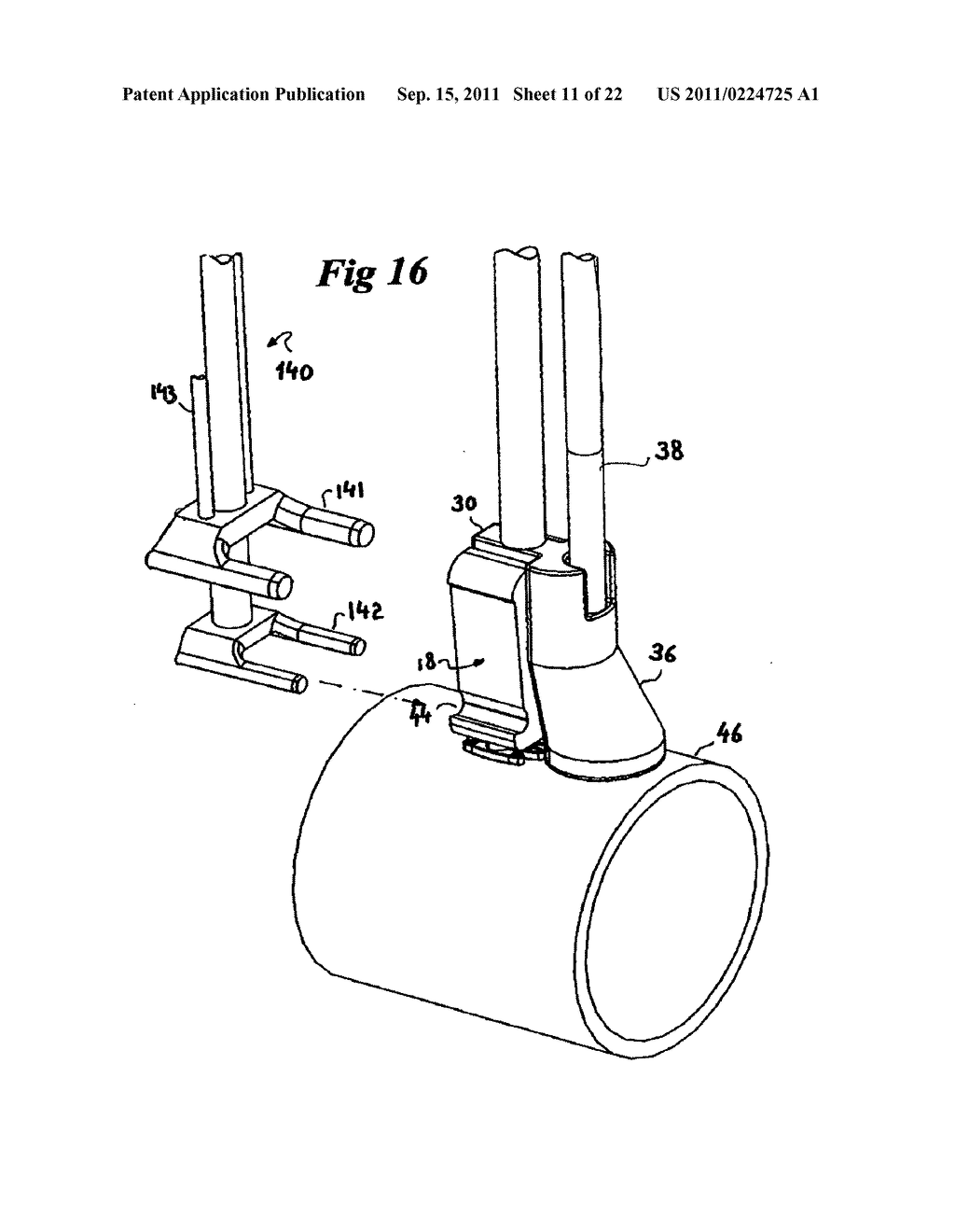 FLUIDTIGHT PUNCTURING AND OCCLUSION DEVICE FOR ANATOMICAL STRUCTURE - diagram, schematic, and image 12