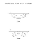 CLOSURE SYSTEM AND USES THEREOF diagram and image