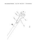 CLOSURE SYSTEM AND USES THEREOF diagram and image