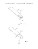 CLOSURE SYSTEM AND USES THEREOF diagram and image