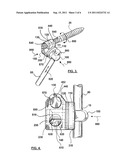 BONE FIXATION APPARATUS diagram and image