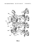 BONE FIXATION APPARATUS diagram and image