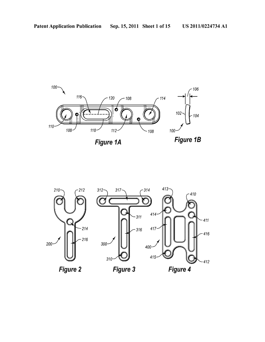 COMPRESSION PLATE KIT AND METHODS FOR REPAIRING BONE DISCONTINUITIES - diagram, schematic, and image 02