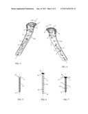 PROXIMAL HUMERUS FRACTURE REPAIR PLATE AND SYSTEM diagram and image