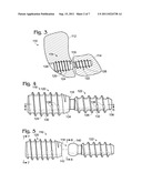 BONE CONNECTOR WITH PIVOTABLE JOINT diagram and image