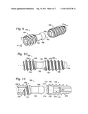 BONE CONNECTOR WITH PIVOTABLE JOINT diagram and image