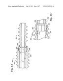 BONE CONNECTOR WITH PIVOTABLE JOINT diagram and image