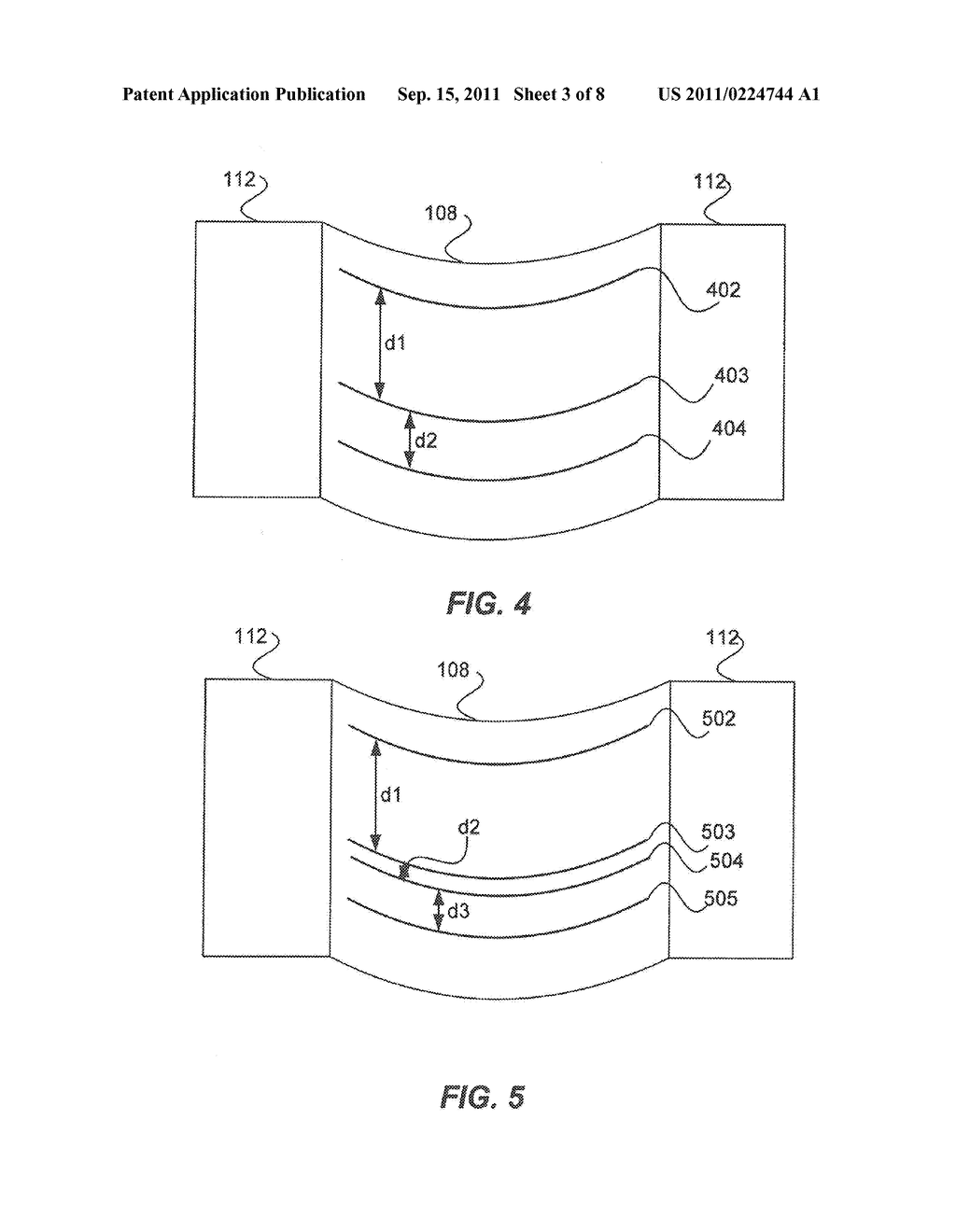 ELECTRODE CONTACT CONFIGURATIONS FOR CUFF LEADS - diagram, schematic, and image 04