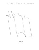 ELECTRODE CONTACT CONFIGURATIONS FOR CUFF LEADS diagram and image