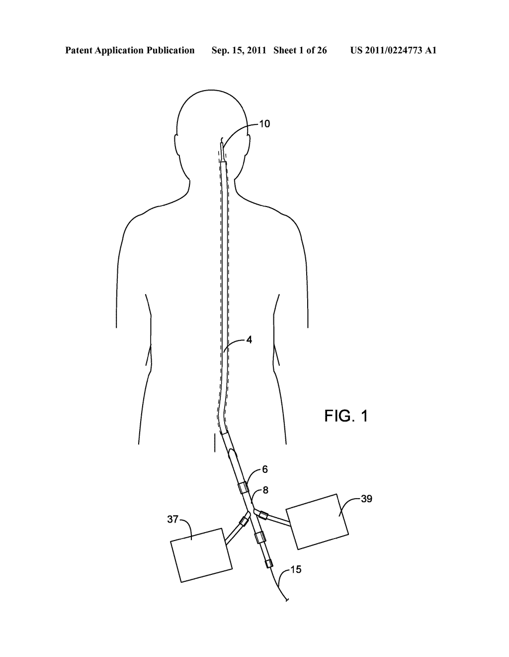 METHODS AND DEVICES FOR PROTECTING A PASSAGEWAY IN A BODY WHEN ADVANCING     DEVICES THROUGH THE PASSAGEWAY - diagram, schematic, and image 02