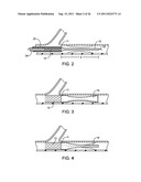 METHODS AND DEVICES FOR PROTECTING A PASSAGEWAY IN A BODY WHEN ADVANCING     DEVICES THROUGH THE PASSAGEWAY diagram and image