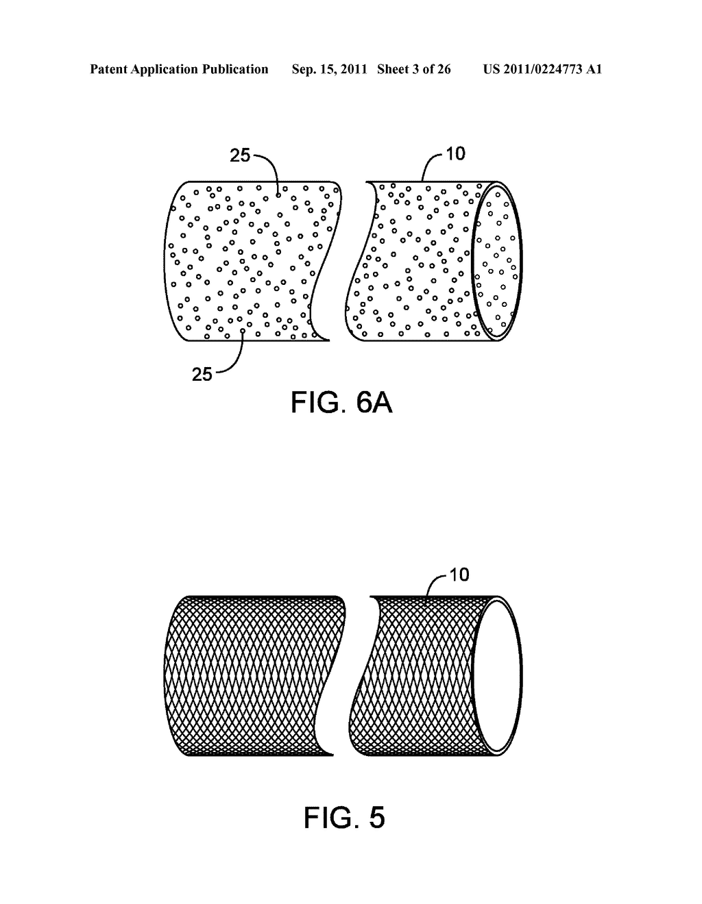 METHODS AND DEVICES FOR PROTECTING A PASSAGEWAY IN A BODY WHEN ADVANCING     DEVICES THROUGH THE PASSAGEWAY - diagram, schematic, and image 04