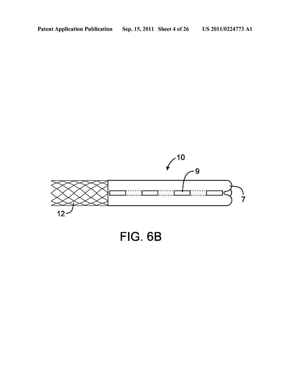 METHODS AND DEVICES FOR PROTECTING A PASSAGEWAY IN A BODY WHEN ADVANCING     DEVICES THROUGH THE PASSAGEWAY - diagram, schematic, and image 05