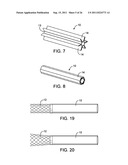 METHODS AND DEVICES FOR PROTECTING A PASSAGEWAY IN A BODY WHEN ADVANCING     DEVICES THROUGH THE PASSAGEWAY diagram and image