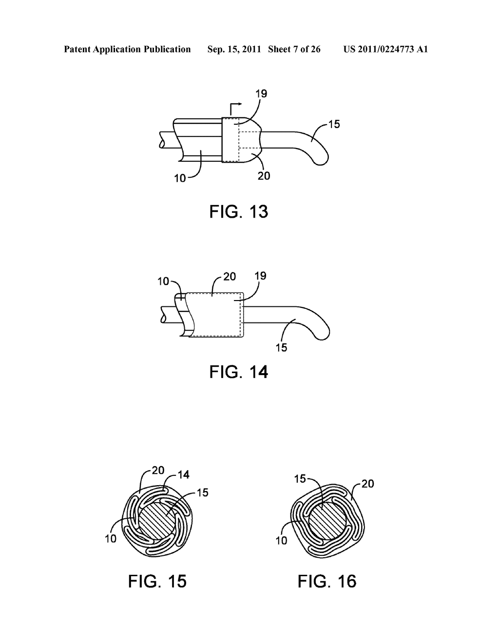 METHODS AND DEVICES FOR PROTECTING A PASSAGEWAY IN A BODY WHEN ADVANCING     DEVICES THROUGH THE PASSAGEWAY - diagram, schematic, and image 08