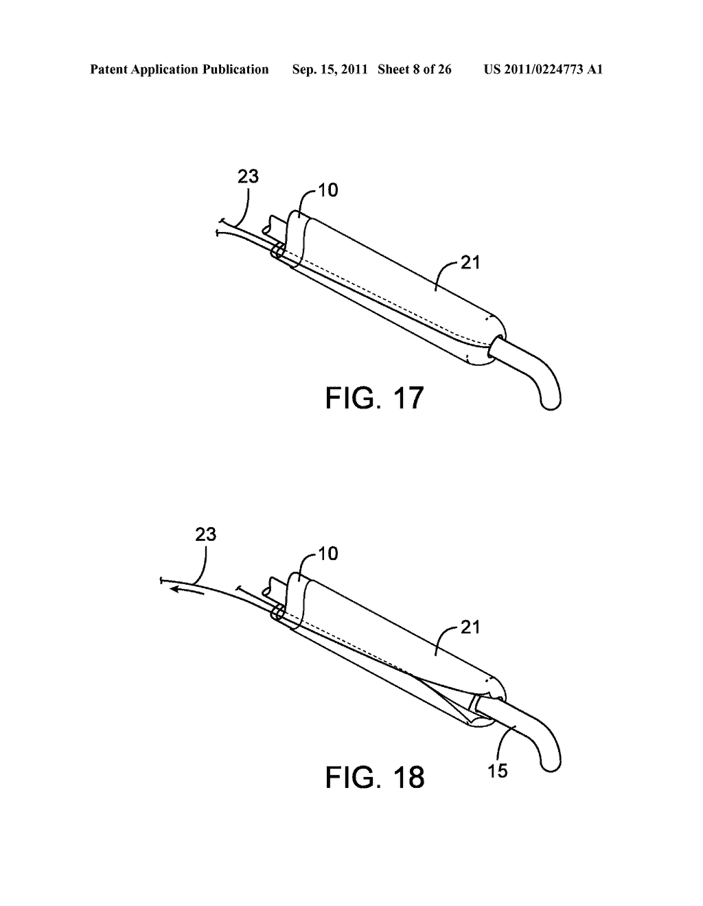 METHODS AND DEVICES FOR PROTECTING A PASSAGEWAY IN A BODY WHEN ADVANCING     DEVICES THROUGH THE PASSAGEWAY - diagram, schematic, and image 09