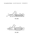 METHODS AND DEVICES FOR PROTECTING A PASSAGEWAY IN A BODY WHEN ADVANCING     DEVICES THROUGH THE PASSAGEWAY diagram and image