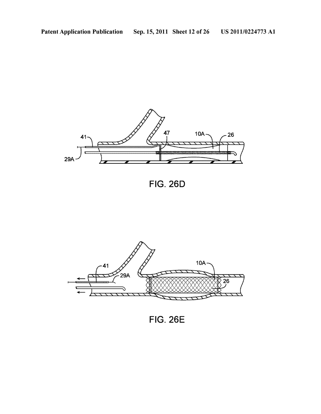 METHODS AND DEVICES FOR PROTECTING A PASSAGEWAY IN A BODY WHEN ADVANCING     DEVICES THROUGH THE PASSAGEWAY - diagram, schematic, and image 13