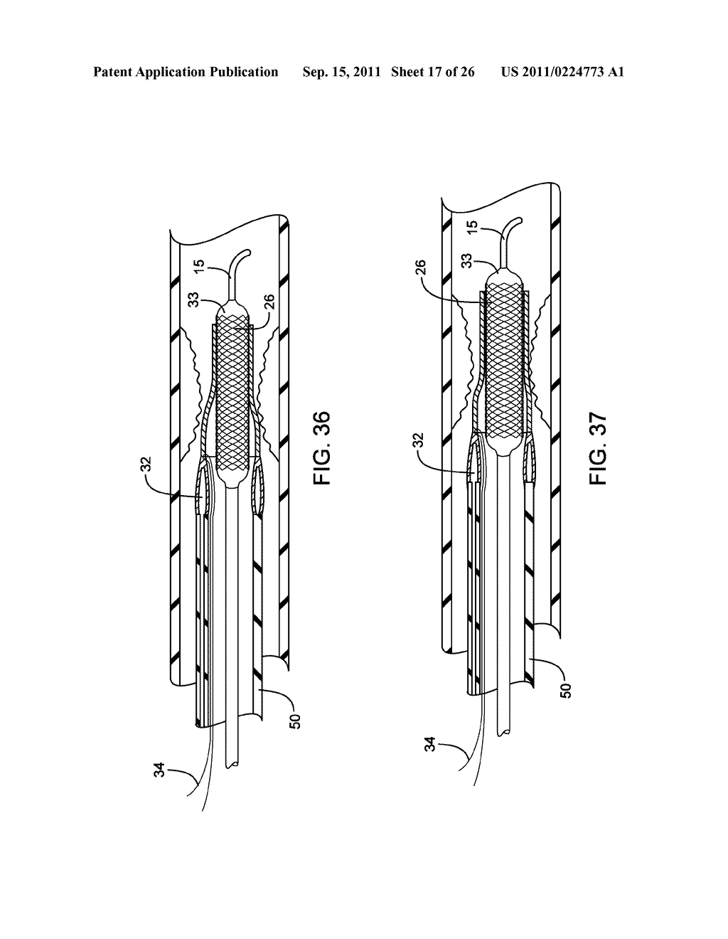 METHODS AND DEVICES FOR PROTECTING A PASSAGEWAY IN A BODY WHEN ADVANCING     DEVICES THROUGH THE PASSAGEWAY - diagram, schematic, and image 18