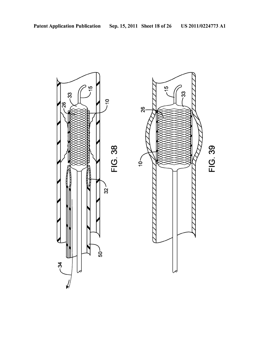 METHODS AND DEVICES FOR PROTECTING A PASSAGEWAY IN A BODY WHEN ADVANCING     DEVICES THROUGH THE PASSAGEWAY - diagram, schematic, and image 19